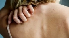 Постелнина и ленено вошки